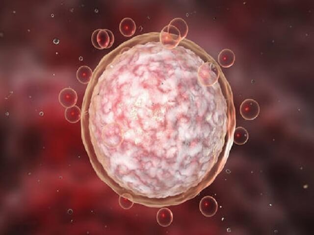 第4次移植后不能下蹲的原因是它影响了床的固定力